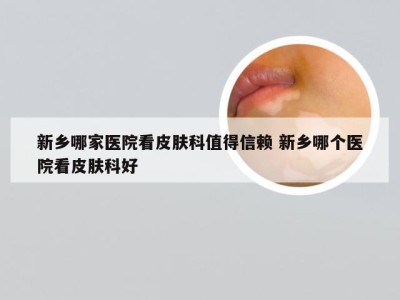 新乡哪家医院看皮肤科值得信赖 新乡哪个医院看皮肤科好