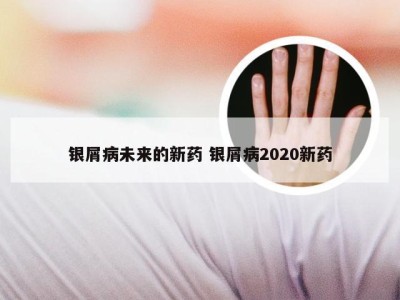 银屑病未来的新药 银屑病2020新药