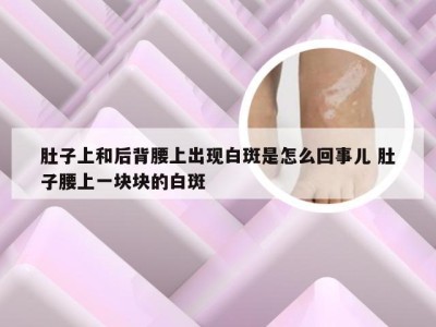 肚子上和后背腰上出现白斑是怎么回事儿 肚子腰上一块块的白斑