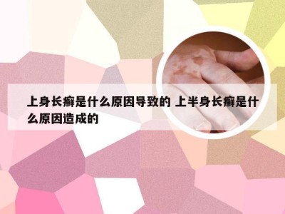 上身长癣是什么原因导致的 上半身长癣是什么原因造成的