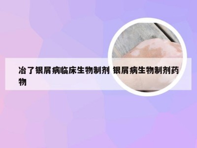 冶了银屑病临床生物制剂 银屑病生物制剂药物