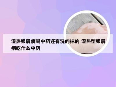 湿热银屑病喝中药还有洗的抹的 湿热型银屑病吃什么中药