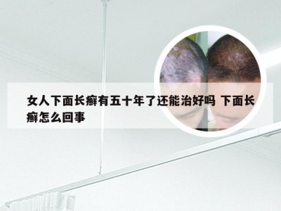 女人下面长癣有五十年了还能治好吗 下面长癣怎么回事