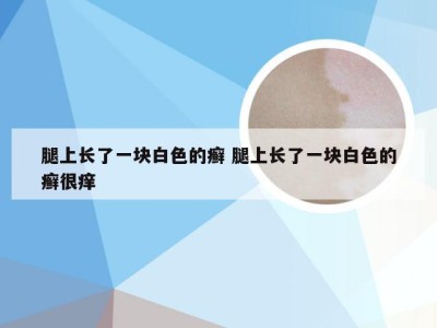 腿上长了一块白色的癣 腿上长了一块白色的癣很痒