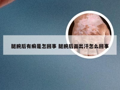 腿腕后有癣是怎回事 腿腕后面出汗怎么回事