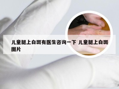 儿童腿上白斑有医生咨询一下 儿童腿上白斑图片