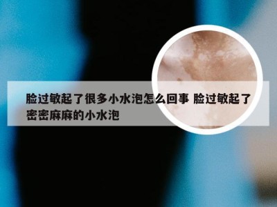 脸过敏起了很多小水泡怎么回事 脸过敏起了密密麻麻的小水泡