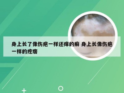 身上长了像伤疤一样还痒的癣 身上长像伤疤一样的疙瘩