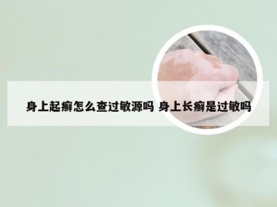 身上起癣怎么查过敏源吗 身上长癣是过敏吗