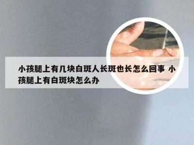 小孩腿上有几块白斑人长斑也长怎么回事 小孩腿上有白斑块怎么办