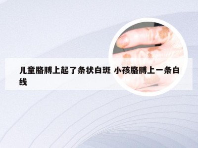 儿童胳膊上起了条状白斑 小孩胳膊上一条白线