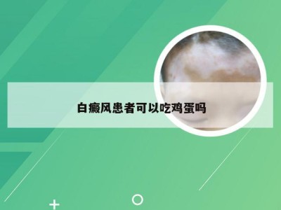 白癜风患者可以吃鸡蛋吗