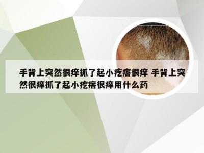 手背上突然很痒抓了起小疙瘩很痒 手背上突然很痒抓了起小疙瘩很痒用什么药