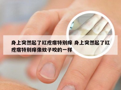 身上突然起了红疙瘩特别痒 身上突然起了红疙瘩特别痒像蚊子咬的一样