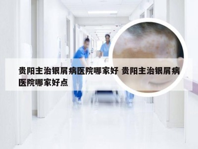 贵阳主治银屑病医院哪家好 贵阳主治银屑病医院哪家好点