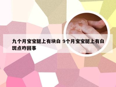 九个月宝宝腿上有块白 9个月宝宝腿上有白斑点咋回事