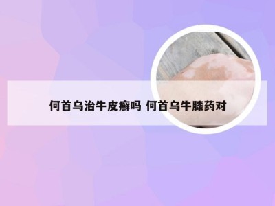 何首乌治牛皮癣吗 何首乌牛膝药对