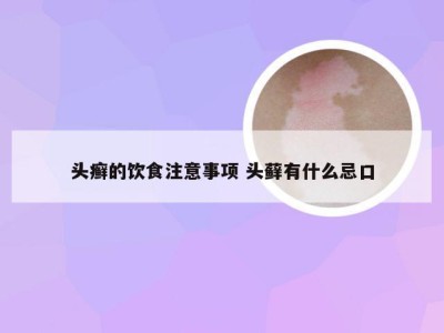 头癣的饮食注意事项 头藓有什么忌口