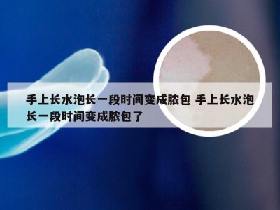 手上长水泡长一段时间变成脓包 手上长水泡长一段时间变成脓包了