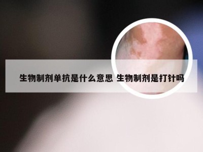 生物制剂单抗是什么意思 生物制剂是打针吗