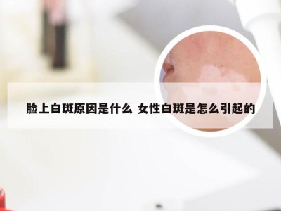 脸上白斑原因是什么 女性白斑是怎么引起的