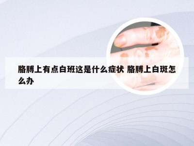 胳膊上有点白班这是什么症状 胳膊上白斑怎么办