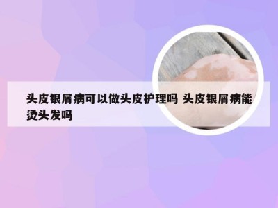 头皮银屑病可以做头皮护理吗 头皮银屑病能烫头发吗