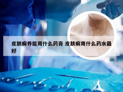 皮肤癣养能用什么药膏 皮肤癣用什么药水最好