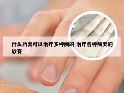 什么药膏可以治疗多种癣的 治疗各种癣类的软膏