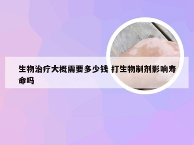 生物治疗大概需要多少钱 打生物制剂影响寿命吗