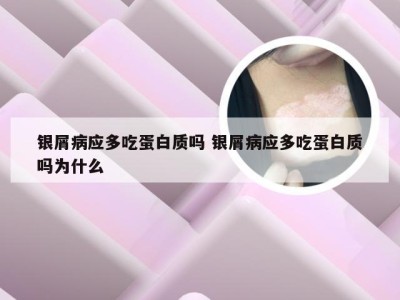 银屑病应多吃蛋白质吗 银屑病应多吃蛋白质吗为什么