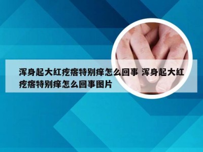 浑身起大红疙瘩特别痒怎么回事 浑身起大红疙瘩特别痒怎么回事图片