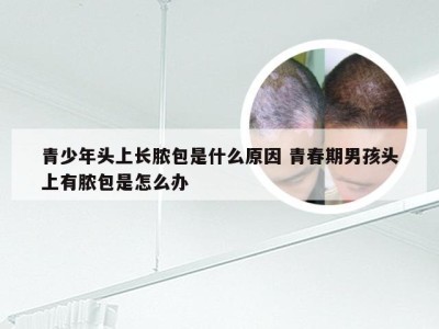 青少年头上长脓包是什么原因 青春期男孩头上有脓包是怎么办