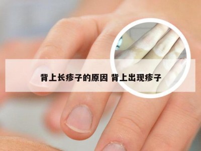 背上长疹子的原因 背上出现疹子