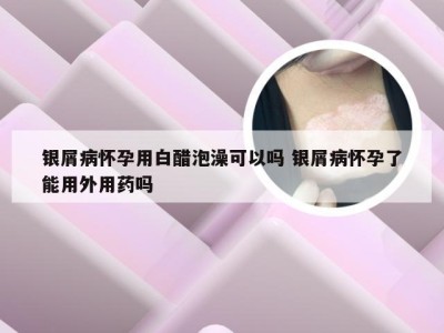 银屑病怀孕用白醋泡澡可以吗 银屑病怀孕了能用外用药吗