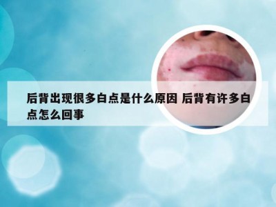 后背出现很多白点是什么原因 后背有许多白点怎么回事