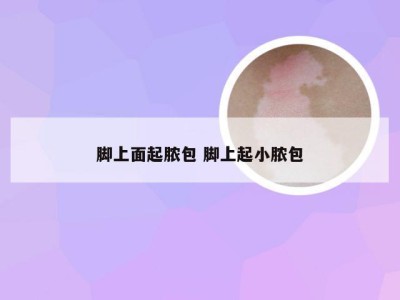 脚上面起脓包 脚上起小脓包