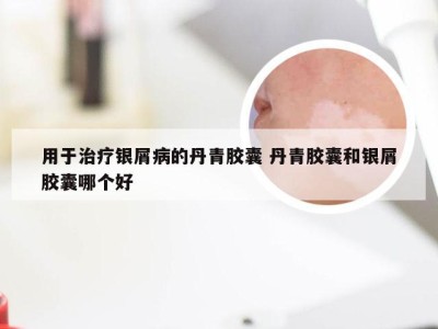 用于治疗银屑病的丹青胶囊 丹青胶囊和银屑胶囊哪个好