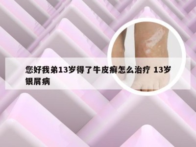 您好我弟13岁得了牛皮癣怎么治疗 13岁银屑病