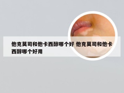 他克莫司和他卡西醇哪个好 他克莫司和他卡西醇哪个好用