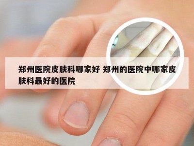 郑州医院皮肤科哪家好 郑州的医院中哪家皮肤科最好的医院