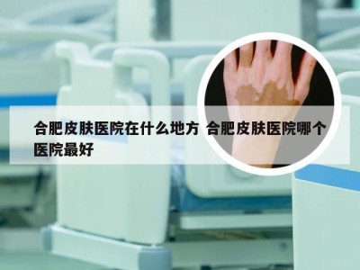 合肥皮肤医院在什么地方 合肥皮肤医院哪个医院最好