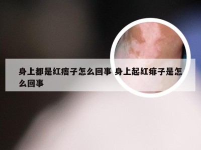 身上都是红痦子怎么回事 身上起红痱子是怎么回事