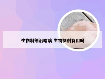 生物制剂治啥病 生物制剂有用吗