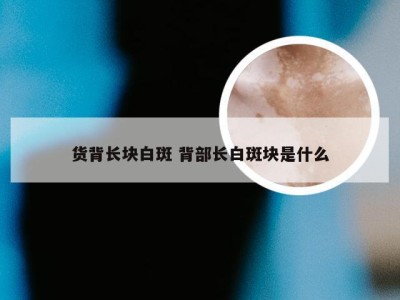 货背长块白斑 背部长白斑块是什么