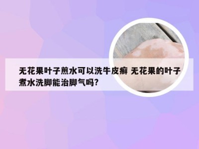 无花果叶子煎水可以洗牛皮癣 无花果的叶子煮水洗脚能治脚气吗?