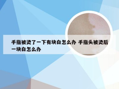 手指被烫了一下有块白怎么办 手指头被烫后一块白怎么办