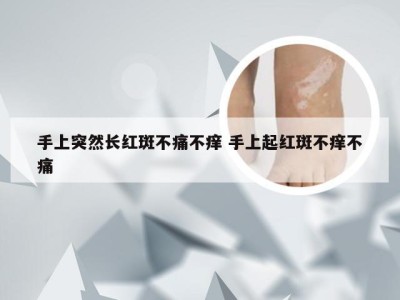 手上突然长红斑不痛不痒 手上起红斑不痒不痛