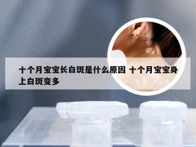 十个月宝宝长白斑是什么原因 十个月宝宝身上白斑变多