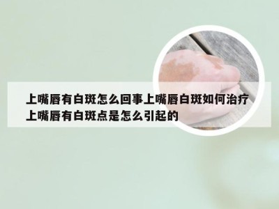 上嘴唇有白斑怎么回事上嘴唇白斑如何治疗 上嘴唇有白斑点是怎么引起的